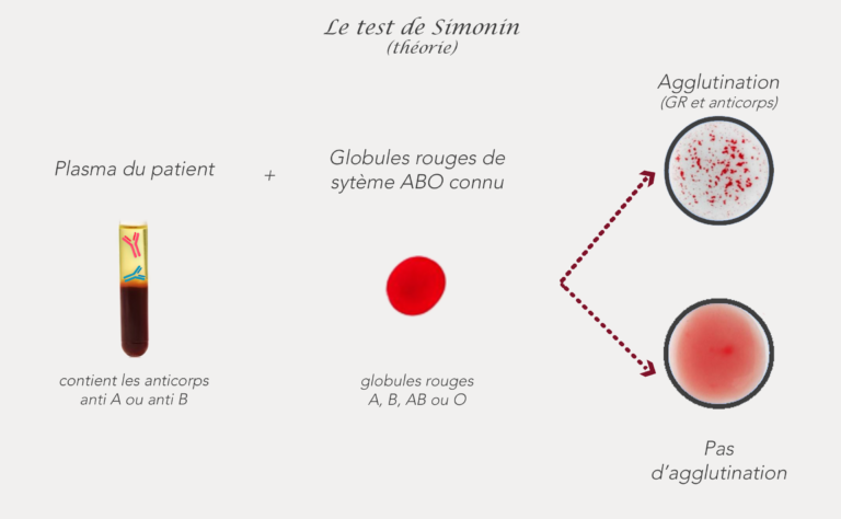 Test de simonin : mise en contact du plasma patient avec des hématies A, B, AB ou O pour voir si une agglutination à lieu.